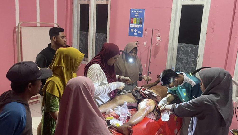 Satu Warga Desa Maidi Kota Tidore Digigit Buaya, Korban Alami Luka di Kaki Kiri